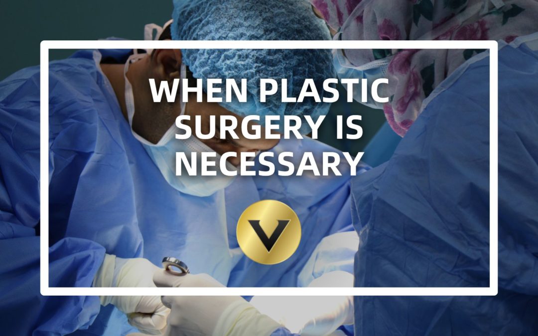 When Plastic Surgery Is Necessary
